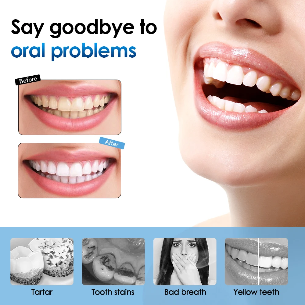 Elettrico Dentale Calcolo Scaler Sbiancamento Dei Denti Placca Macchia di Caffè Rimozione Tartaro Ad Alta Frequenza Sonic Spazzolino Da Denti Detergente