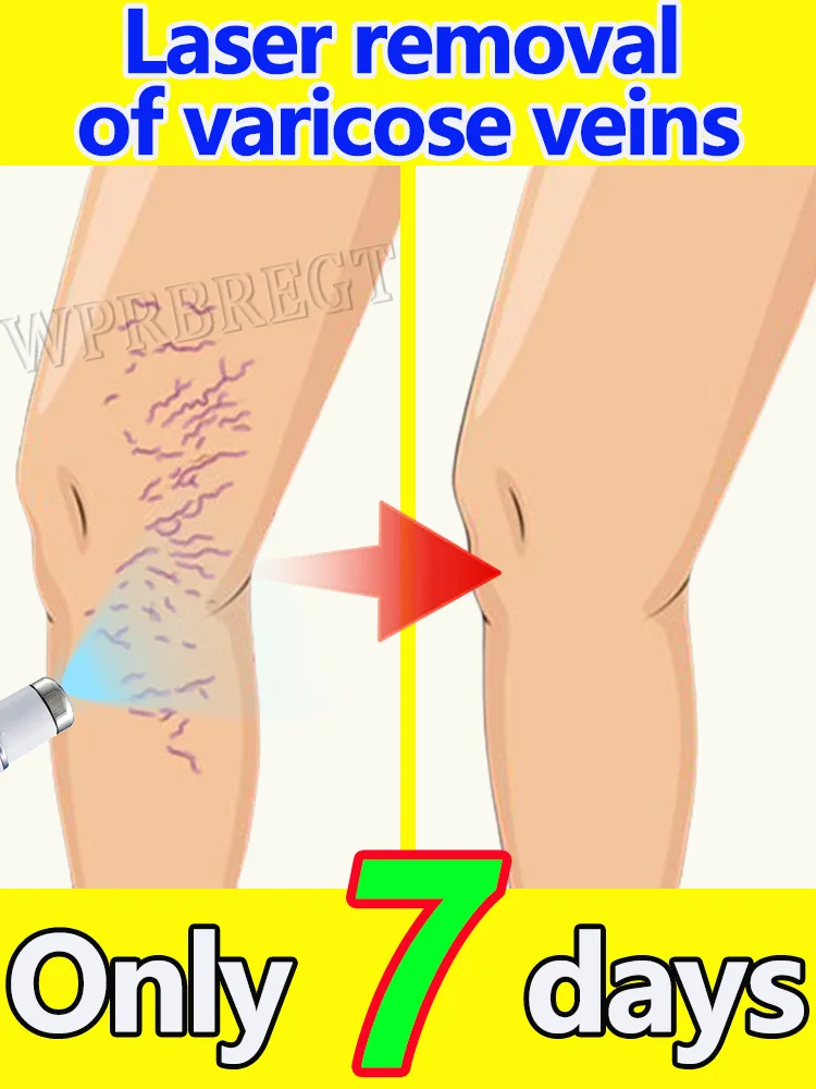 Blue light pen body care to improve legs
