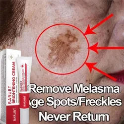 Effective Whitening Freckles Face Cream Removal Melasma Dark Spots Fade Melanin Pigmentation Corrector Brighten Repair Skin Care