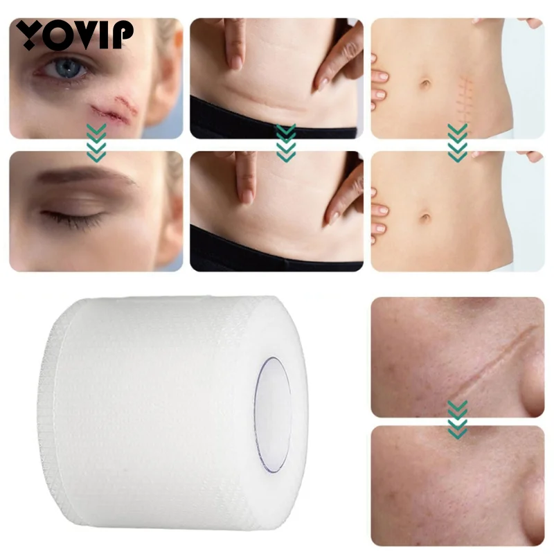 Silicone Scar Patch Transparent Scar Tape Roll Scar Sheet Removal Self-Adhesive Tape Therapy Patch Burn Acne Surgical Scar Skinc