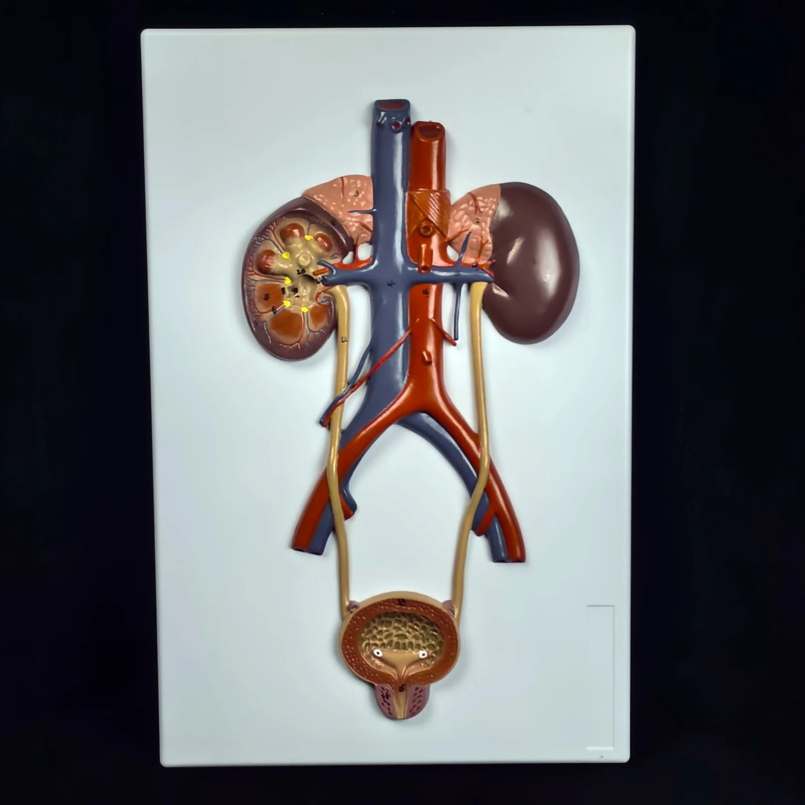 PVC Anatomy Teaching Model Medical Bladder Liver Kidney Wall Plaque Urinary System
