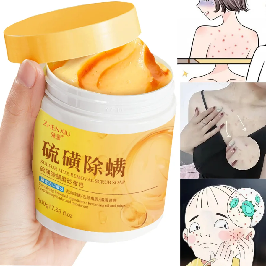 500g/17.63.FL.OZ élimination des acariens au soufre gommage savon Gel douche nettoyant pour le corps nettoyage en profondeur du dos grande bouteille lavage du corps quotidien Anti-acné