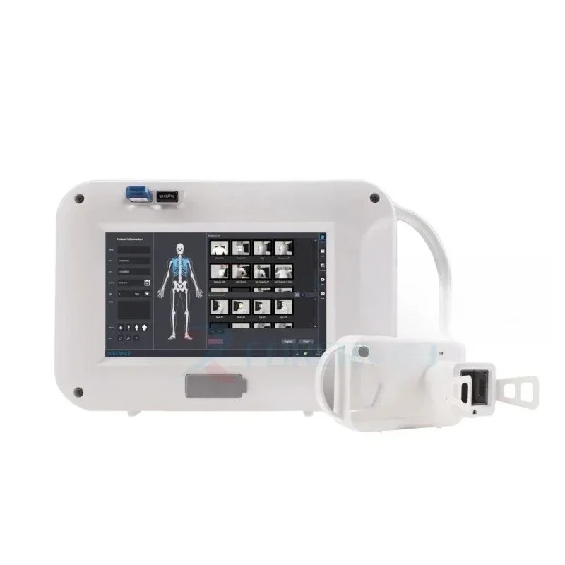 Dealer-only Special Offer Hot Wireless Portable Digital Xray Machine Bulit-in Computer DR Handheld X Ray Equipment