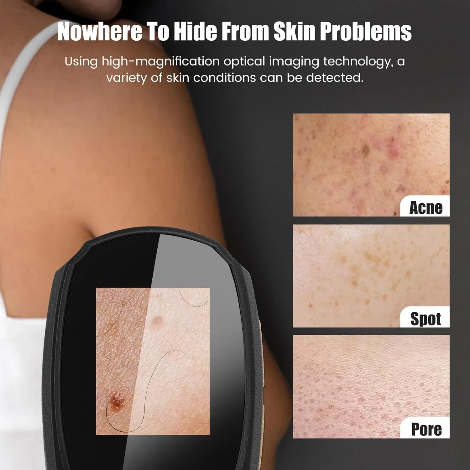 منظار الجلد المحمول مجهر رقمي مع شاشة 1080P IPS، مكبر 500X لفروة الرأس/الشعر تريكومز الوجه