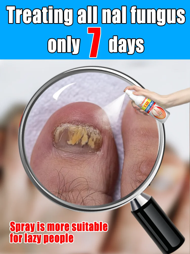 

2025 Toenail Fungus Waterproof Nail Repair, Ingrown Nail Correction, Discolored and Damaged Nails, Foot Care Tools