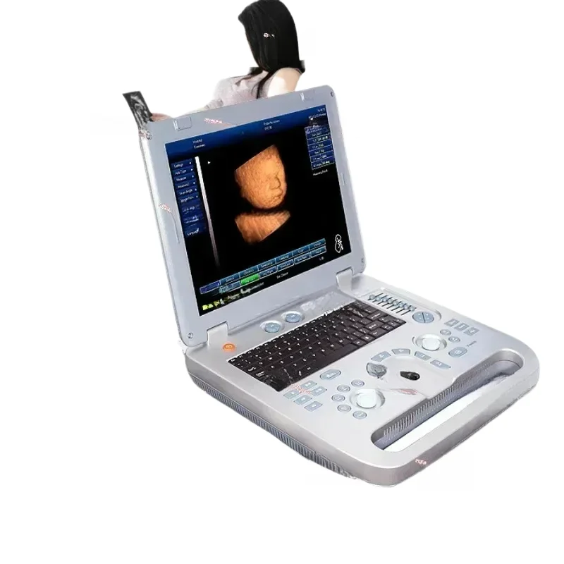 High Quality 3D Ultrasound Medical Scan Digital Pseudo Color Usg 4D Optional Ecography