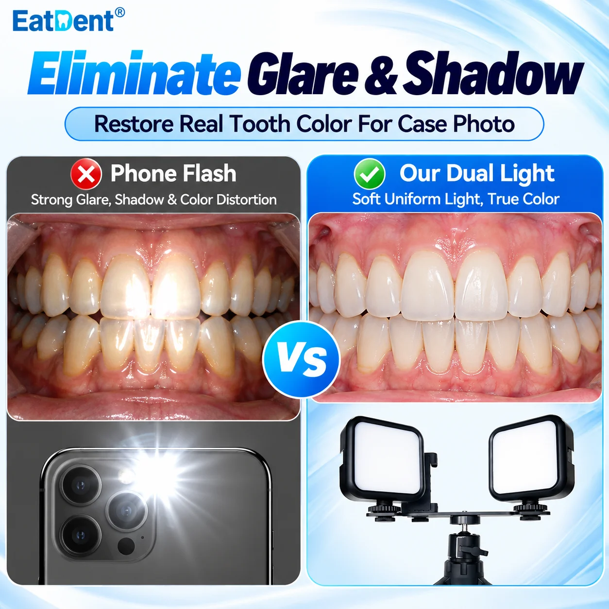7W Dental Intraoral Photography Light Dual LED Fill Light 3 Color Temperature Dental Filling Light with Tripod Phone Holder