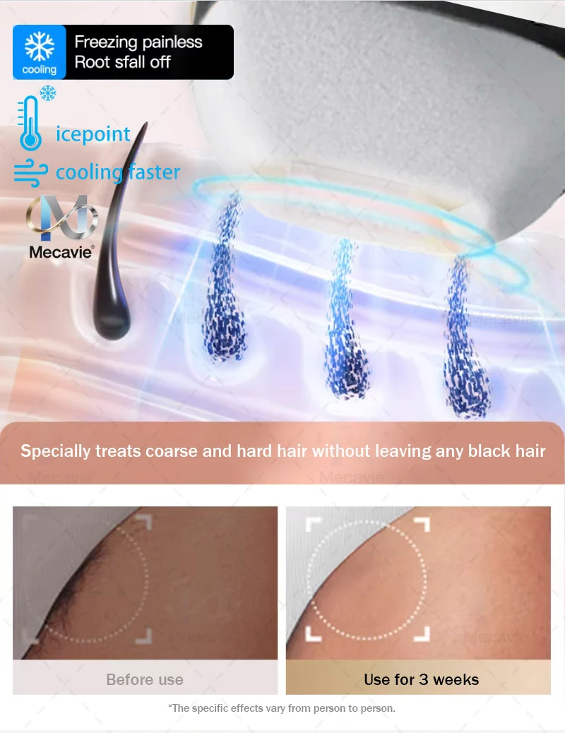 Beauty Slaon 4000W soprano diode laser carbon stripping 4 wavelength ice point painless hair removal machine