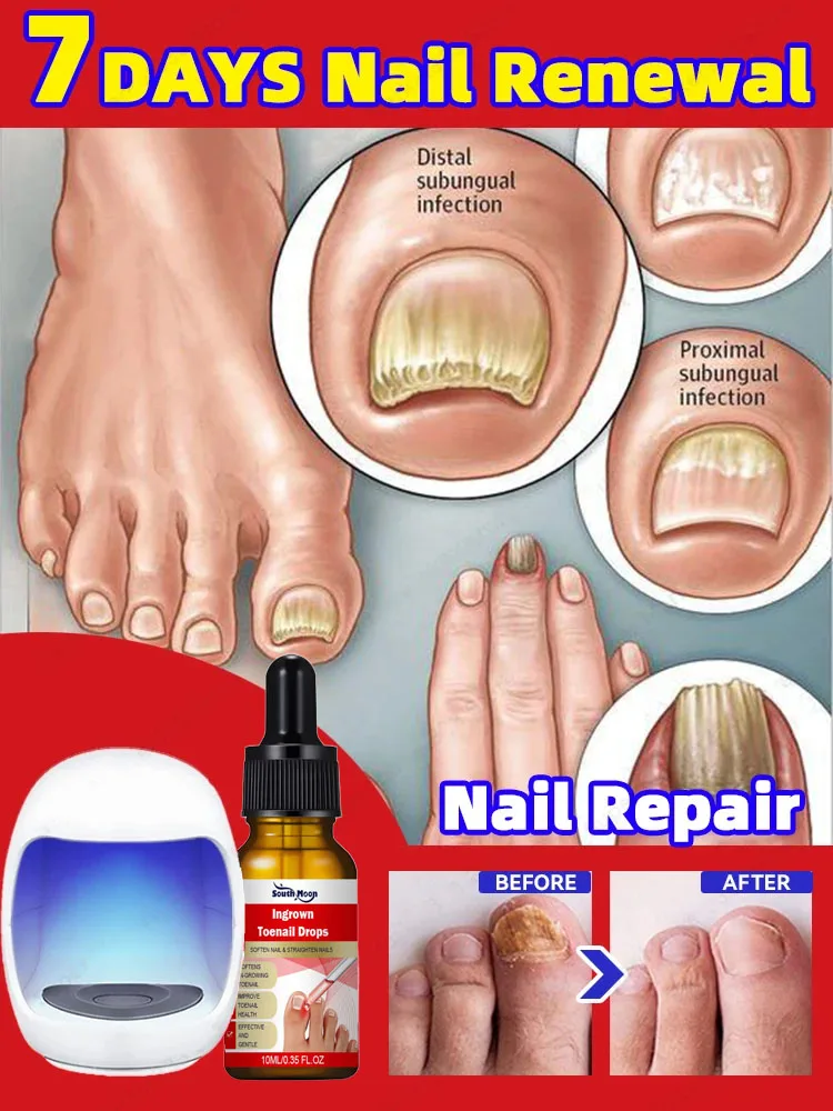 

решает все проблемы ногтей.