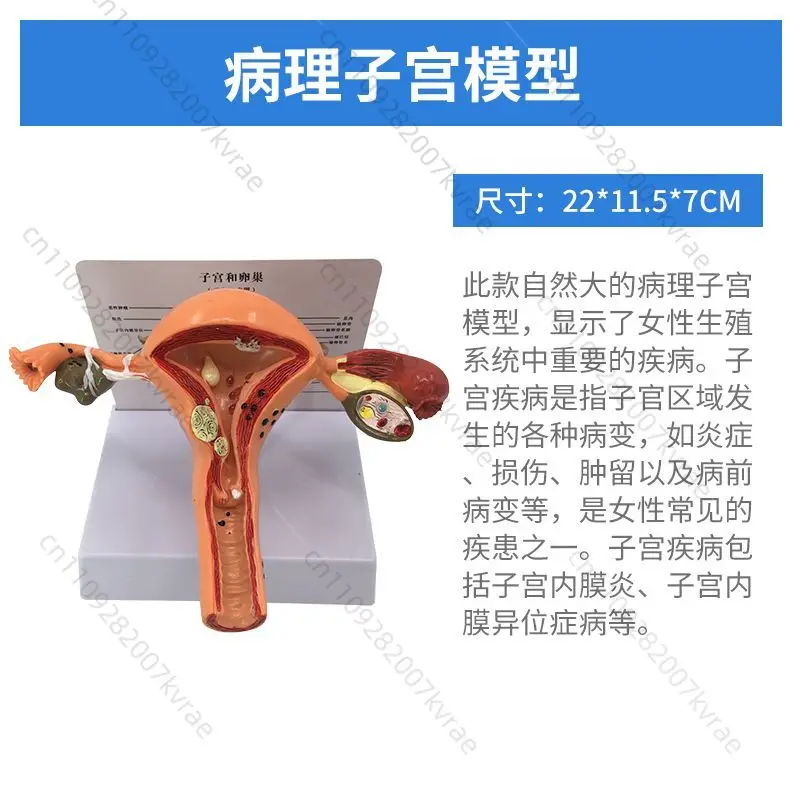 Female Reproductive Structure Silicone Learning Model, Gynecology Science Teaching Tool