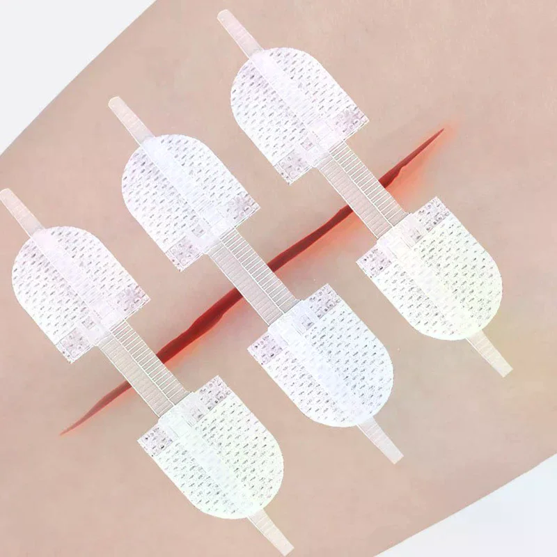 

Breathable Seamless Elastic Strap Zipper Wound Closure Patches For Wound Care Braces Supports - Seamless Zip Sutures Bandages