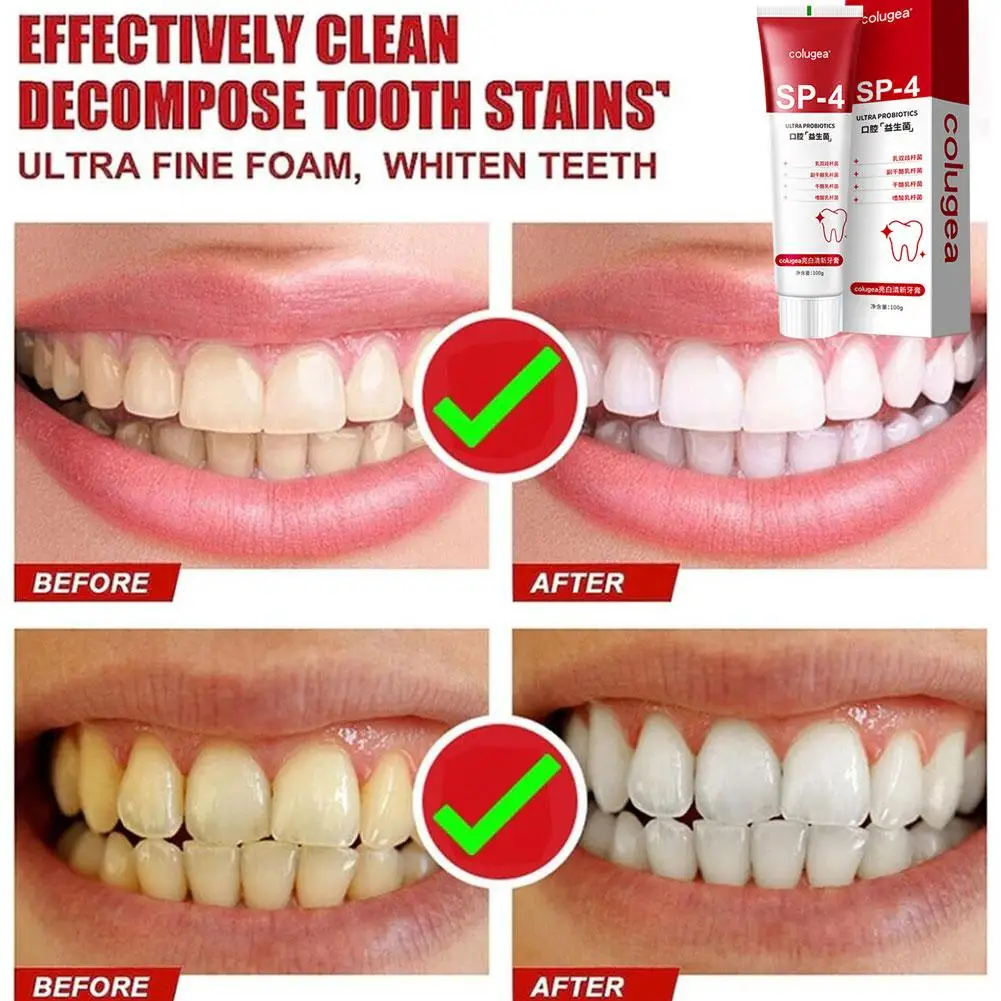 100g SP-4 Probiotic Whitening Shark Toothpaste Teeth Fresh Breath Toothpaste Care Oral Prevents Whitening Toothpaste