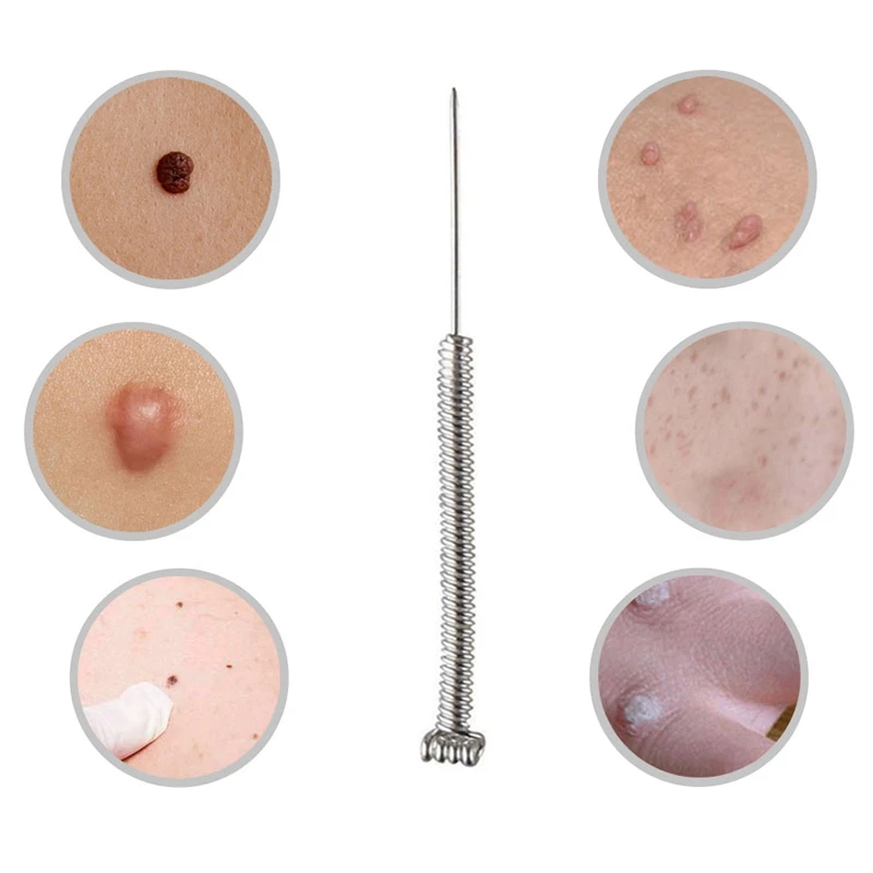 Caneta Agulhas Kit Plasma Para Verrugas Tag Removedor de Tatuagem Caneta Agulhas Dedicados Para A Laser Máquina Da Remoção do Freckle Toupeira Pele