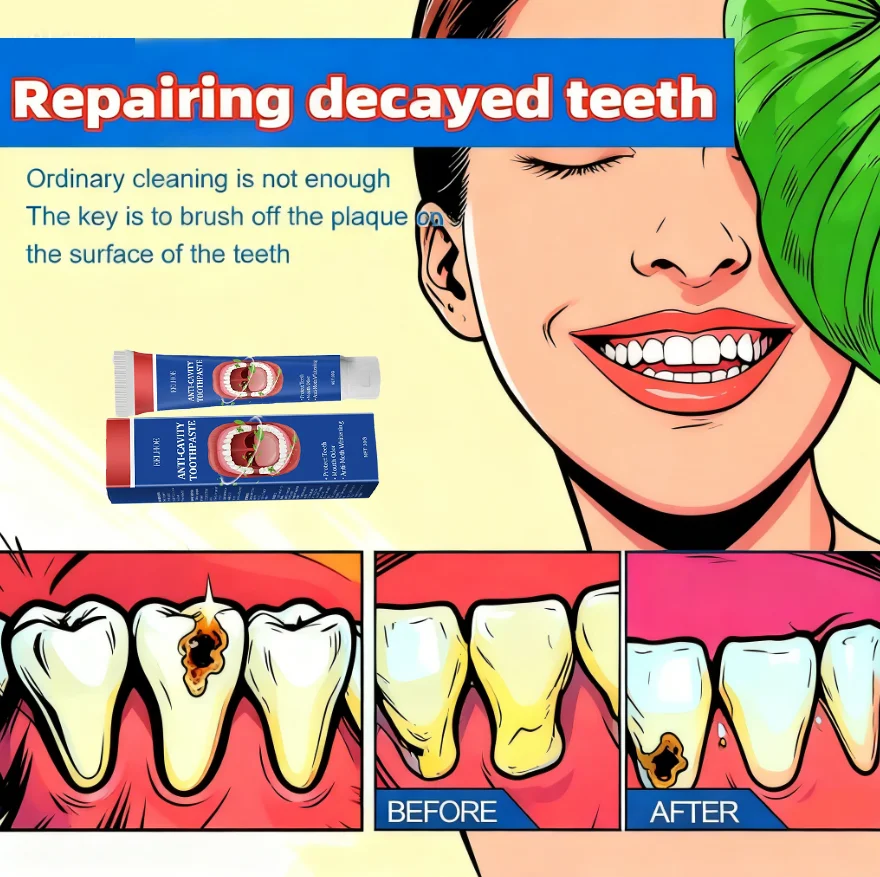 7-day oral toothpaste for preventing tooth decay and effectively removing dental plaque