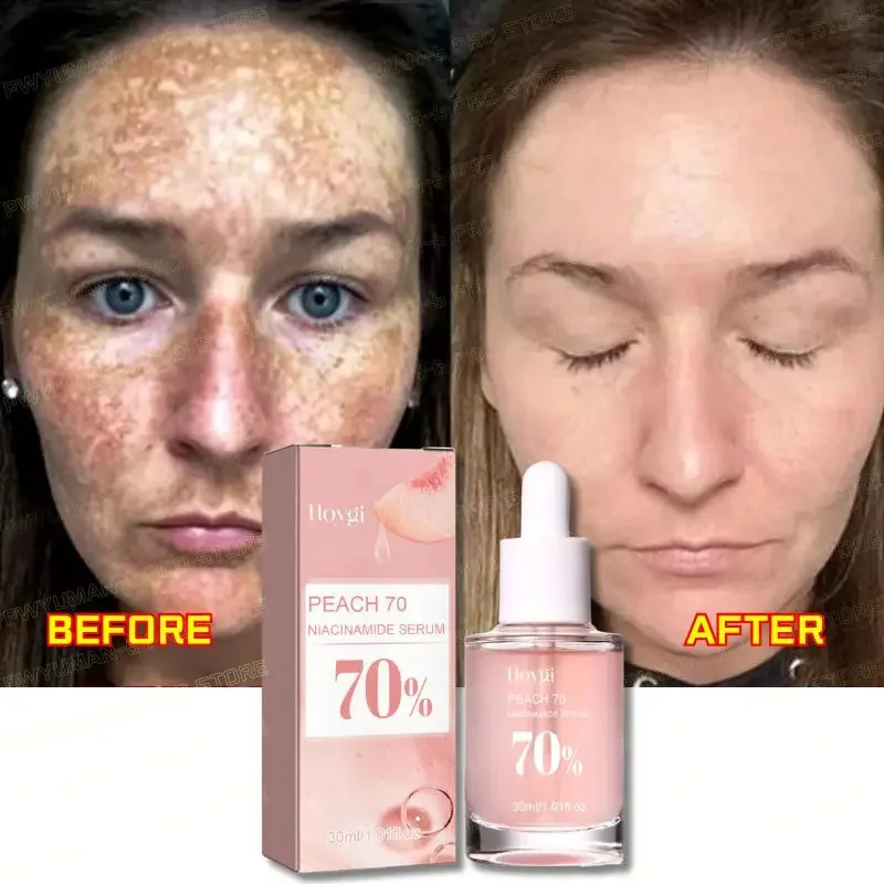 Peach Niacinamide Face Brightening Serum Fade Fine Lines Essence Women Moisturize Face Fade Dull Melasma Lighten Skin Care