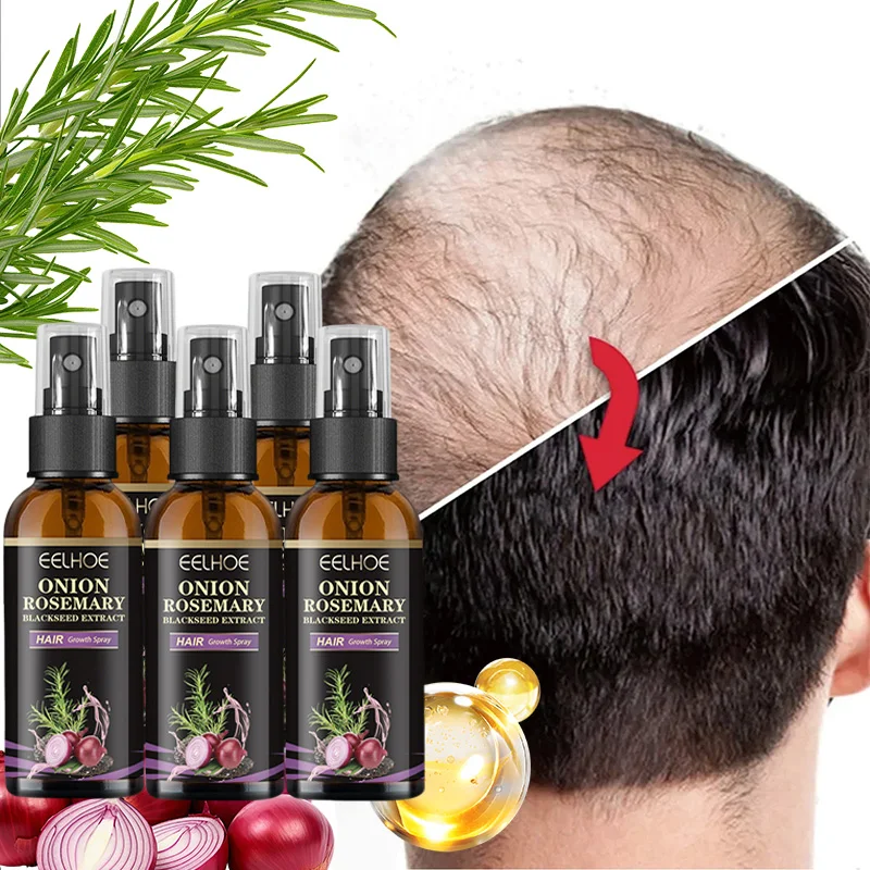 5 Bottle 30ml Onion Rosemary Anti-Hair Loss Serum Rapid Hair Growth Conditioning Spray (for Men & Women)
