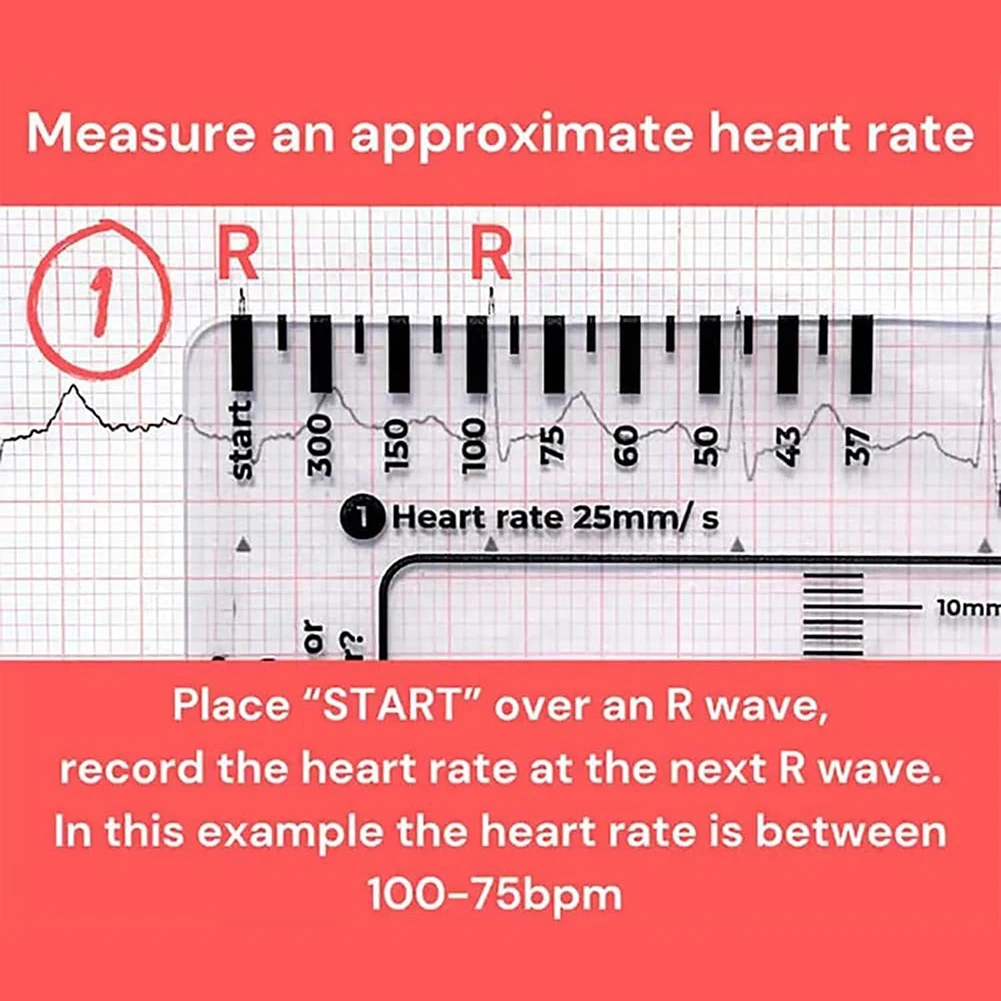 Electrocardiogram 7 Step Ruler Transparent EKG Calipers Measuring Portable Pocket ECG Nurse Easy Carry Ruler EKG Interpretation