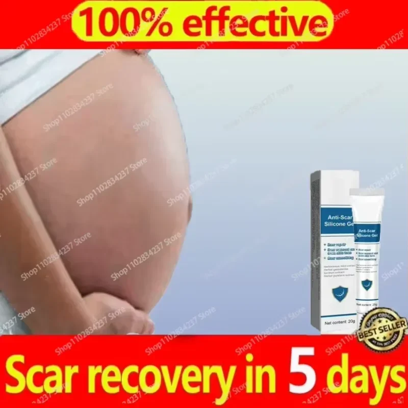 

Cream For Pregnancy Stretch Marks Removal Eliminate Red White Old Stretch Marks Oil 2024