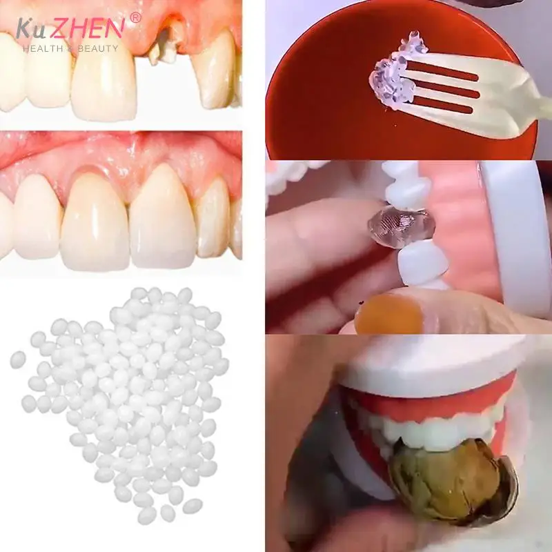 ResinTemporary Tooth Repair Kit Teeth And Gaps FalseTeeth Solid Glue Denture Adhesive Teeth Whitening Tooth Beauty 5g/20g