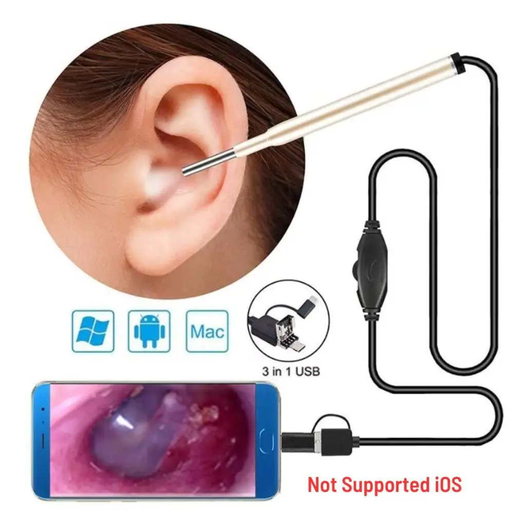 

3.9mm 720P HD Otoscope Visual Ear Cleaning Endoscope Ent Inspection Camera with 6 LED Lights, Support Android and PC