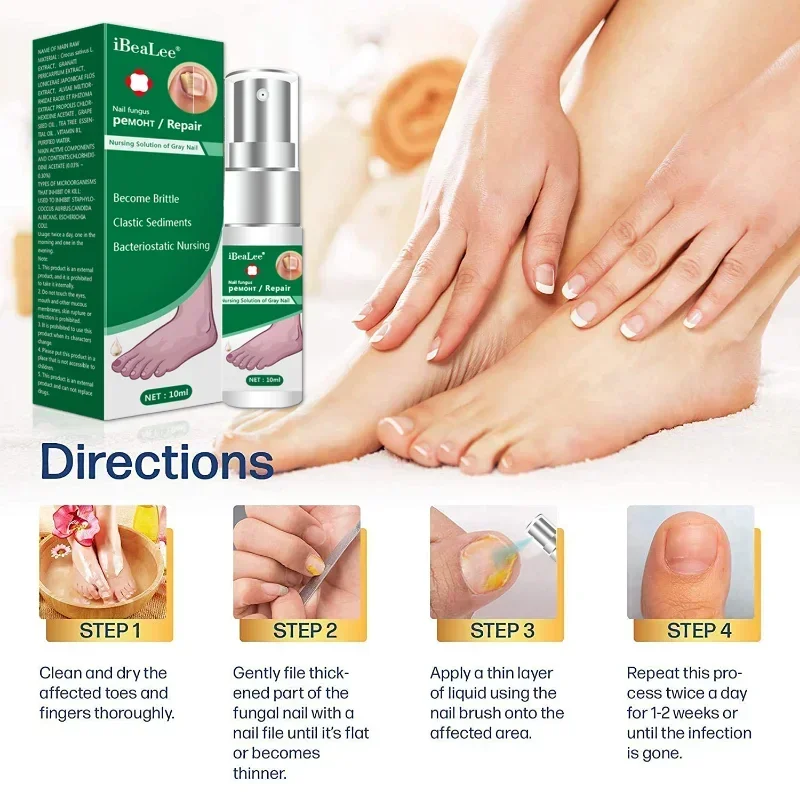 10ML Nail Fungus Fungal Removal Repair Spray Nail Care Treatment OilAnti Infection Foot Caring Onychomycosis Serum Skin Care