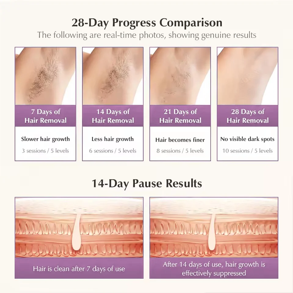 Thumbnail 4 - #71 Best IPL Devices to Buy In 2026