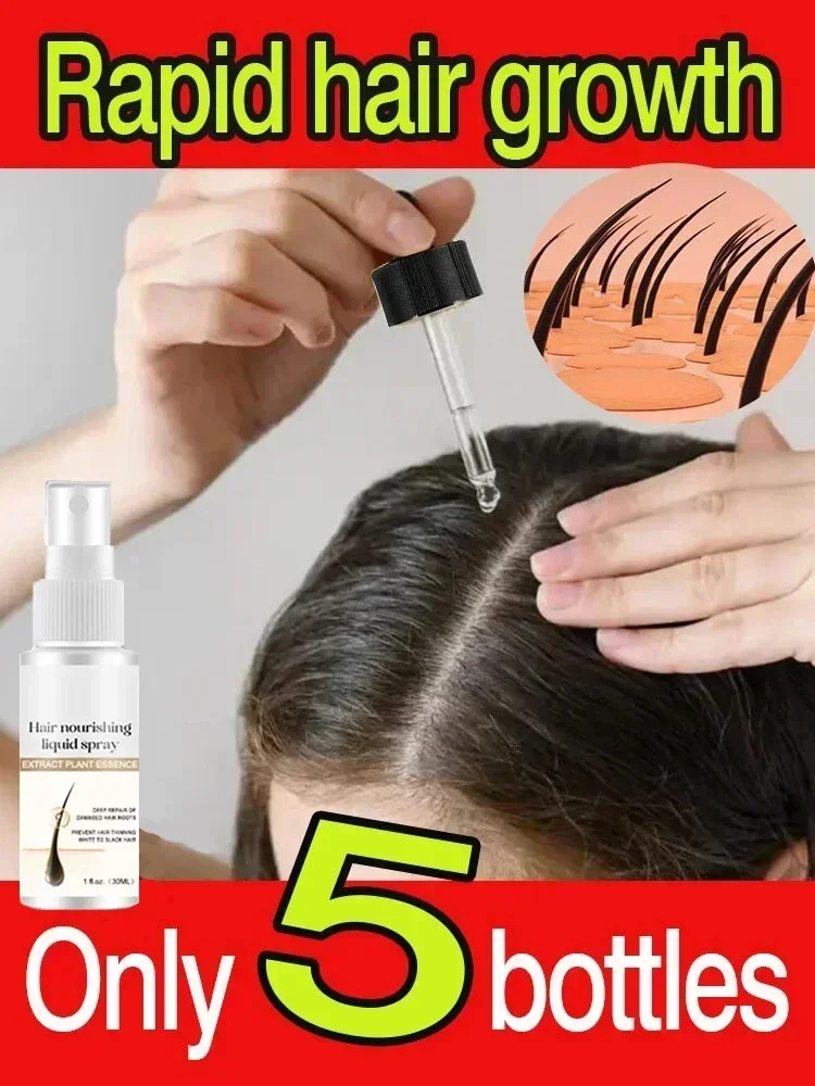 Spray de jengibre para el crecimiento del cabello para hombres y mujeres, suero de crecimiento de raíces más largas y más gruesas, previene la calvicie, Anti pérdida de cabello, cuidado del cabello