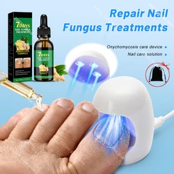 Fungal Nail Treatment Device Repair Fast Nails Fungus Onychomycosis Repair Toenail Fingernail Removes Nail Fungus Foot Care