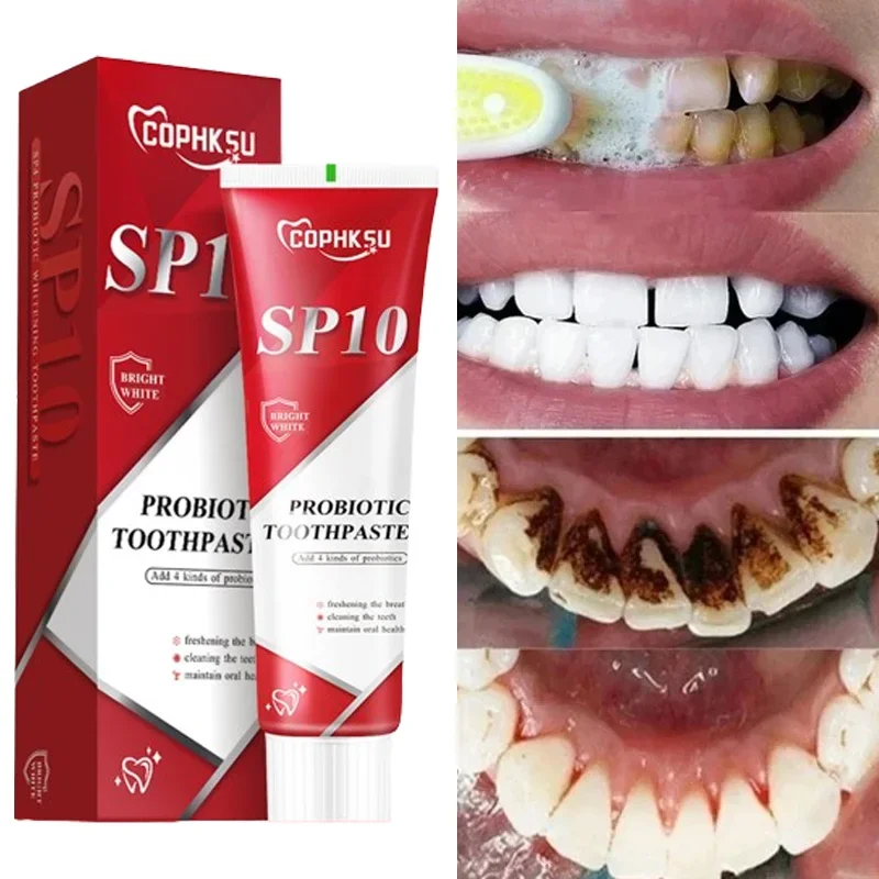 SP-10 dentifricio probiotico sbiancare i denti rimuovere le macchie di placca sbiancante per i denti igiene orale pulito alito fresco prodotto per la cura dei denti