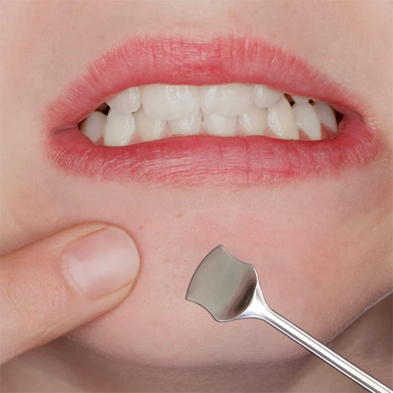 2-In-1 Stainless Steel Professional Blackhead Remover Blemish Extractor Tool Pimple Comedone Removal For Face