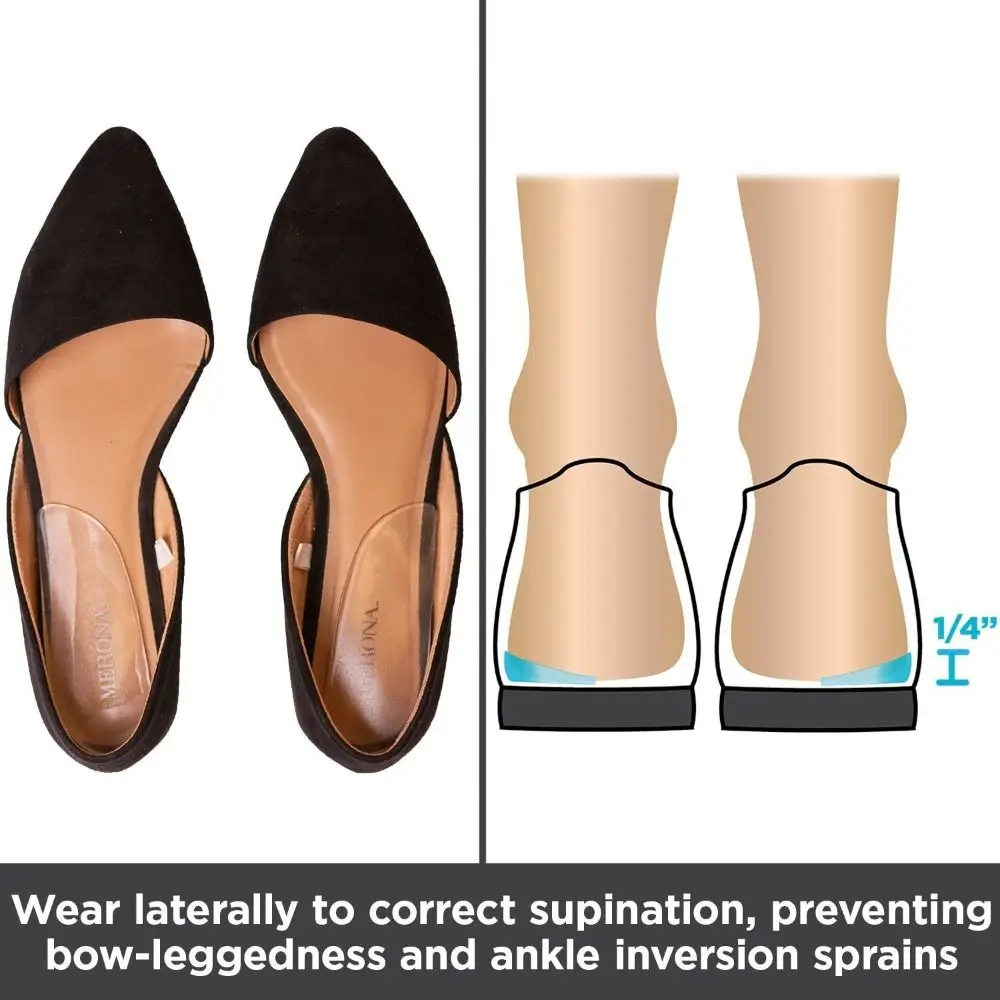 2 Pairs Silicon Corrective Shoe Inserts O/X Type Legs Foot Care Orthopedic Insoles Medial & Lateral Pads Heel Wedge Men Women