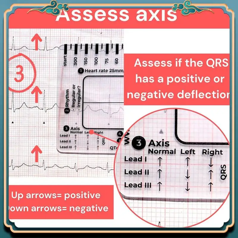 (Новинка) - Шаговая линейка ЭКГ 7, шаговая линейка ЭКГ для перевода ЭКГ/ЭКГ, инструмент для быстрого и быстрого анализа кардиологического анализа и измерения