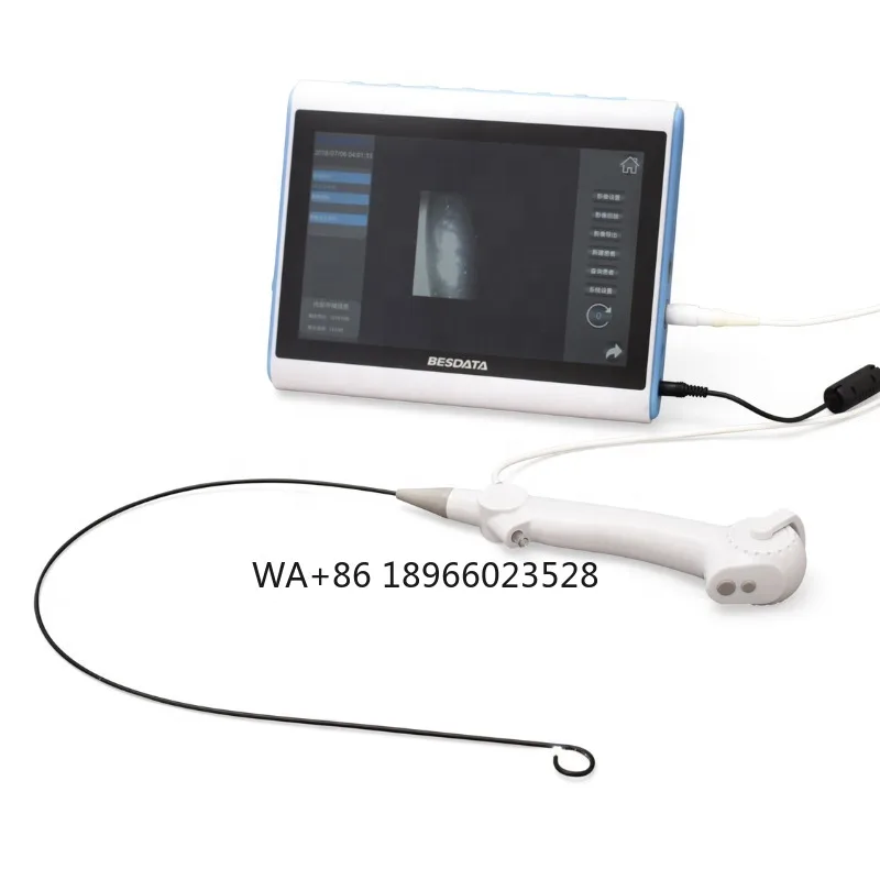 for stone cone urology endoscopy Flexible endoscope