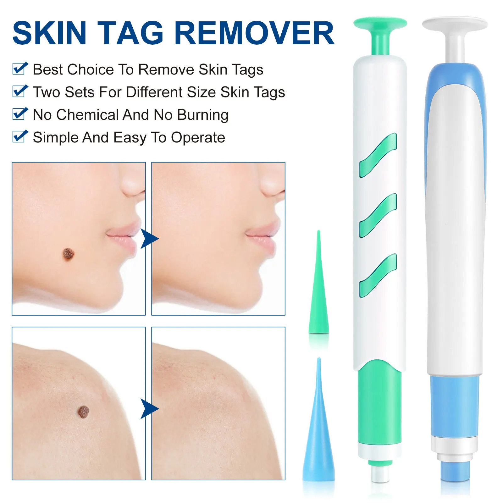Kit de eliminación automática de etiquetas de piel 2 en 1 para etiquetas de piel pequeñas y grandes, 1-9mm con hisopos de limpieza, herramienta de cuidado de la piel facial para uso doméstico