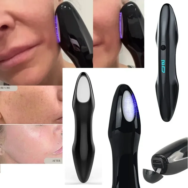 

Latest Portable Plasma Beauty Machine Acne Treatment Ozone Plasma Pen