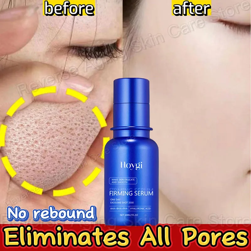 

Blue Microneedle Shrink Pores Facial Essence Whitening Lifting Firm Fine Line Serum Moisturise Melanin Remove Skin Care Product