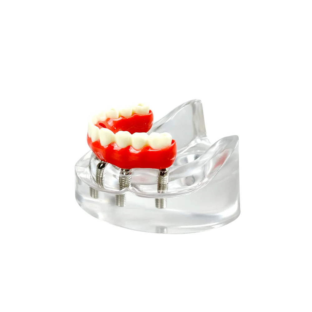Thumbnail 4 - #21 Latest Dental Teaching Models Offers
