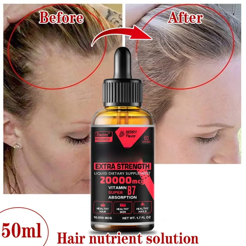 Aceite de crecimiento rápido del cabello, esencia de regeneración del cabello, tratamiento de adelgazamiento del cabello, fluido para el crecimiento del cabello, cuidado antipérdida de cabello para hombres y mujeres