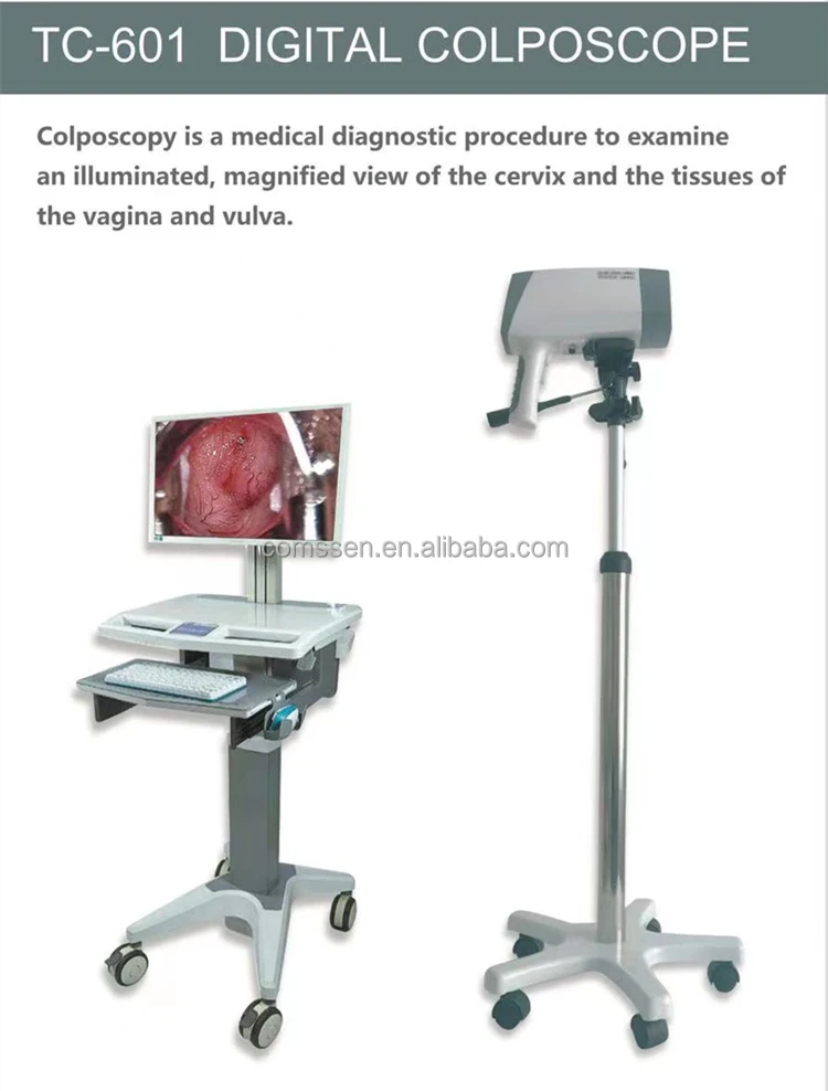 Gynecological examination equipment digital video