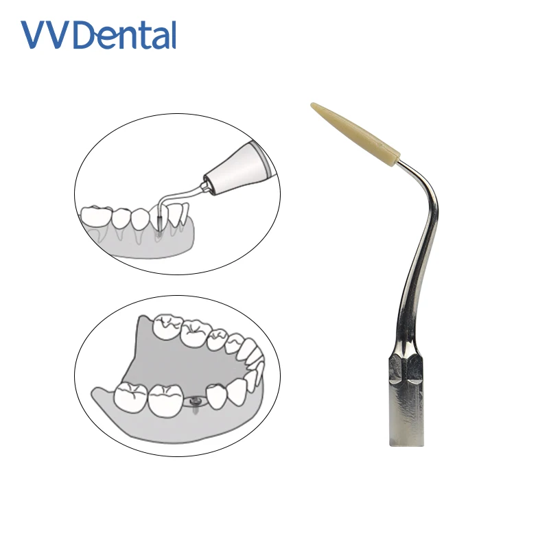 Dentistry Ultrasonic Scaler Tip Fit Woodpecker/EMS Scaler Handpiece Dental Cleaning Ceramic Maintenance Implanting Peek Tip  P90