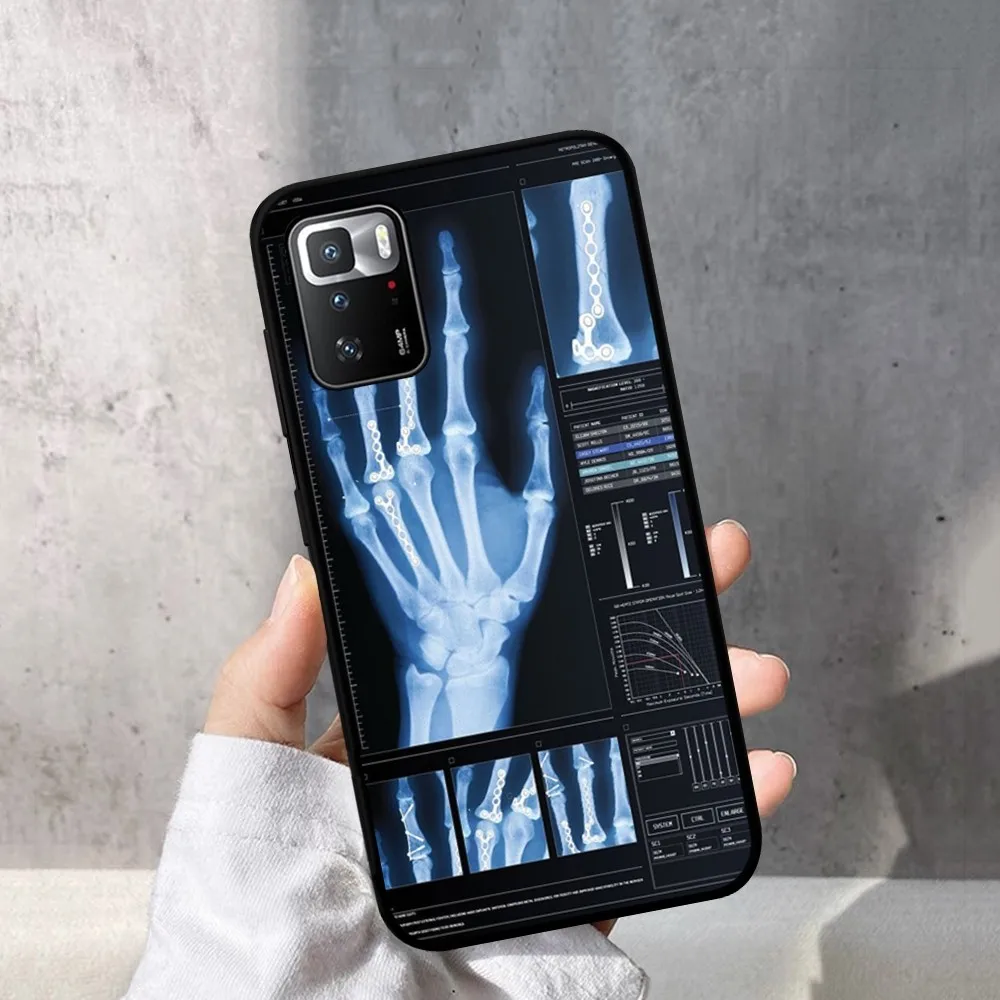 Radiological human organs Skeleton Phone Case For Redmi Note 4 X 5 A 6 7 8 Pro T9 9S 10 11 11S 11E pro PocoM3pro