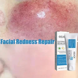 Facial Redness Repair Cream Improve Sensitive Skin Dryness Moisturizer Hydrating Sooth Lotion Removal Rosacea Korean Cosmetics