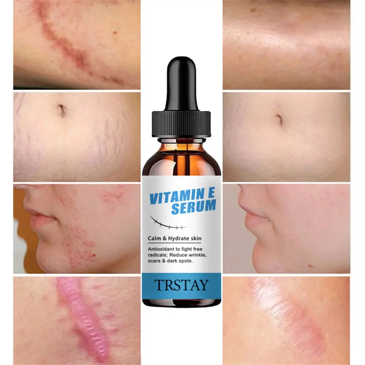 

TRSTAY витамин Е эссенция уход за кожей увлажняющий крем для уменьшения морщин шрамы и пятен выцветание для беременных Striae Gravidarum Care