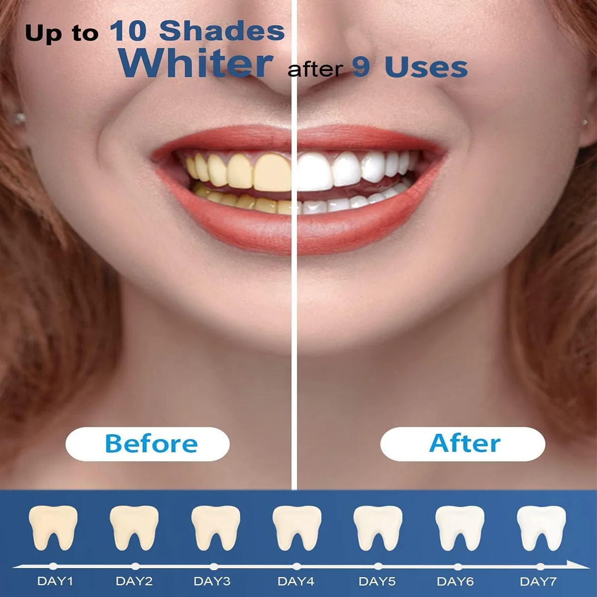 Teeth Whitening Kit - 5X LED Light Tooth Whitener With 3 Gel  , Tray Case For Teeth Sensitive Helps Remove Smoking/Coffee Stain