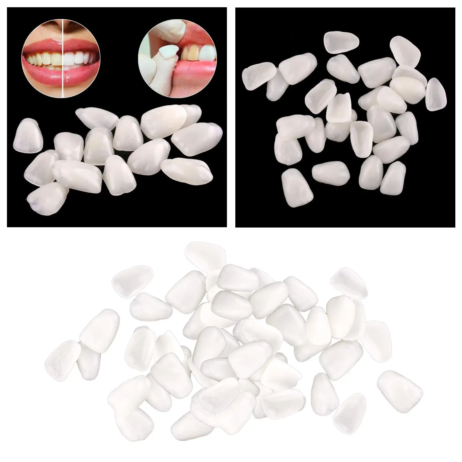 Dental Tooth Temporary Veneers Upper Anterior Front Resin