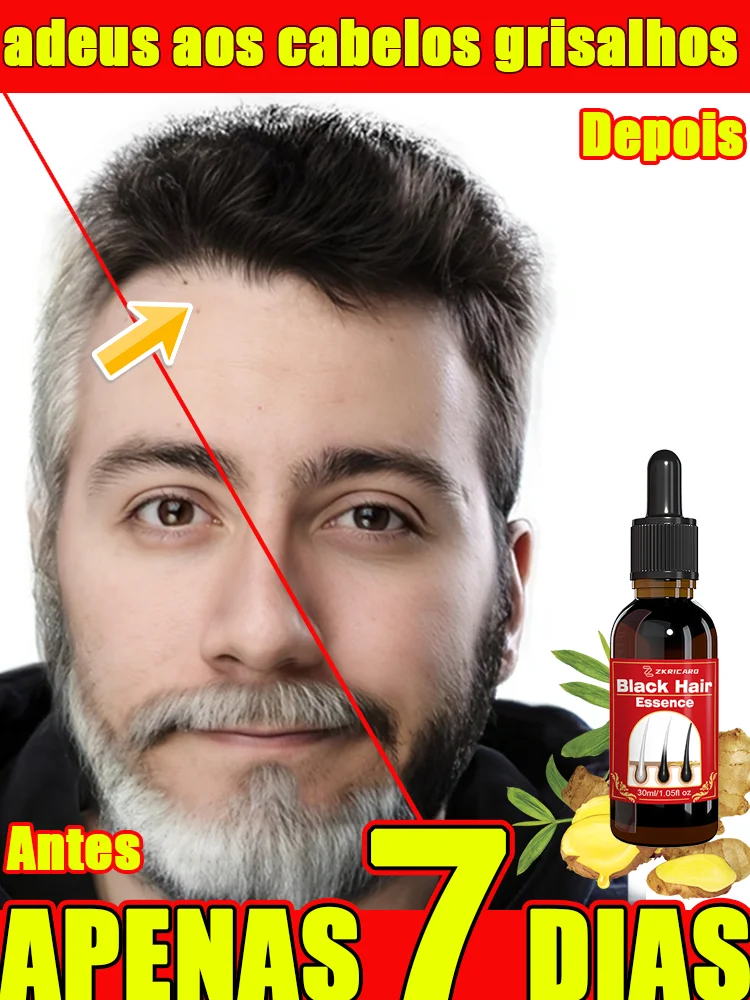 ᴺᵃᵗᵘʳᵃˡ-ᴬⁿᵗⁱ⁻ᴳʳᵃʸ-ᴴᵃⁱʳ-ᔆᵉʳᵘᵐ⠘-⁷⁻ᴰᵃʸ-ᴰᵃʳᵏ-ᴴᵃⁱʳ-ᴿᵉˢᵗᵒʳᵃᵗⁱᵒⁿ-⁹⁸-ᴳʳᵃʸ-ᴾʳᵉᵛᵉⁿᵗⁱᵒⁿ-⁻-ᴿᵒᵒᵗ-ᴿᵉᵖᵃⁱʳ-ʷⁱᵗʰ-ᴮᵒᵗᵃⁿⁱᶜᵃˡ-ᴱˣᵗʳᵃᶜᵗ