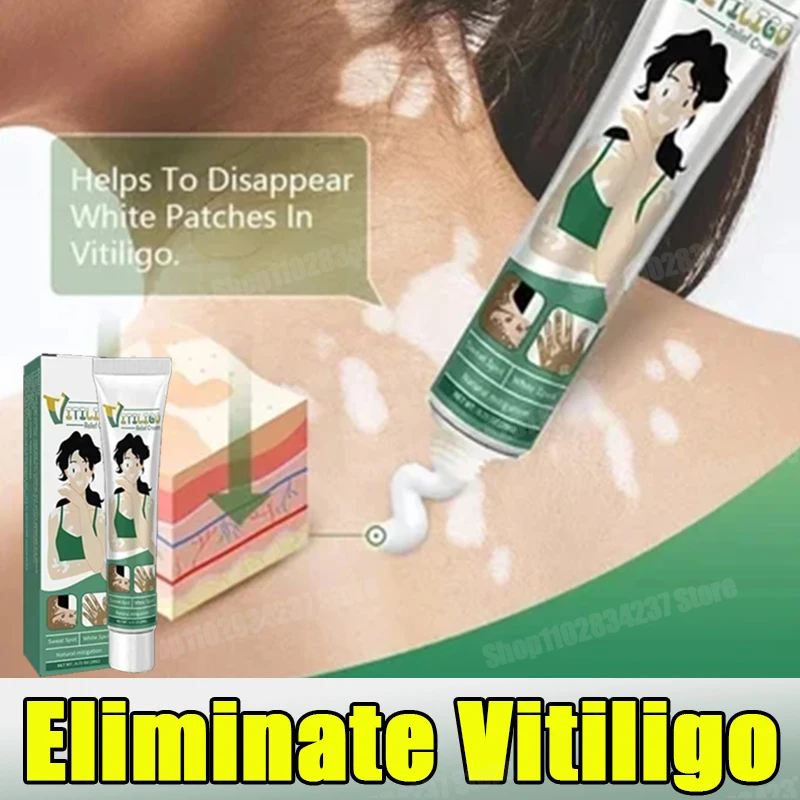 

Vitiligo Safe Repair Brightening Lasting Increase Confidence Improve Skin Appearance Natural Ingredients 2024