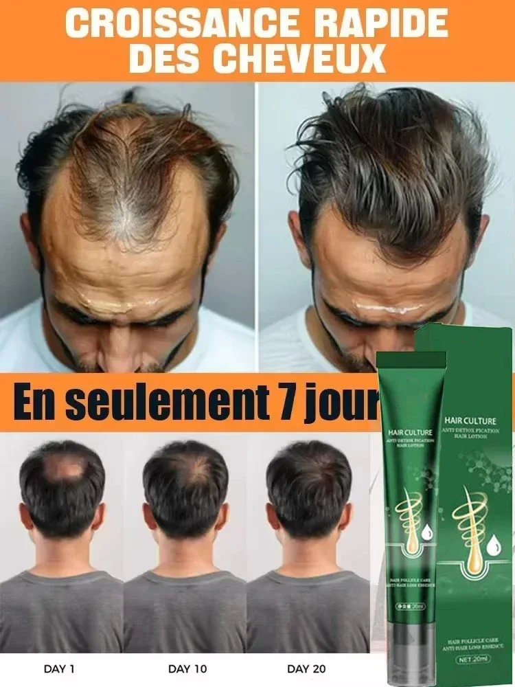 

Man Hair Growth Essential Loss Regrowth Treatment Strengthens Hair Nourishes Scalp Light Weight Non Greasy Improve Scalp