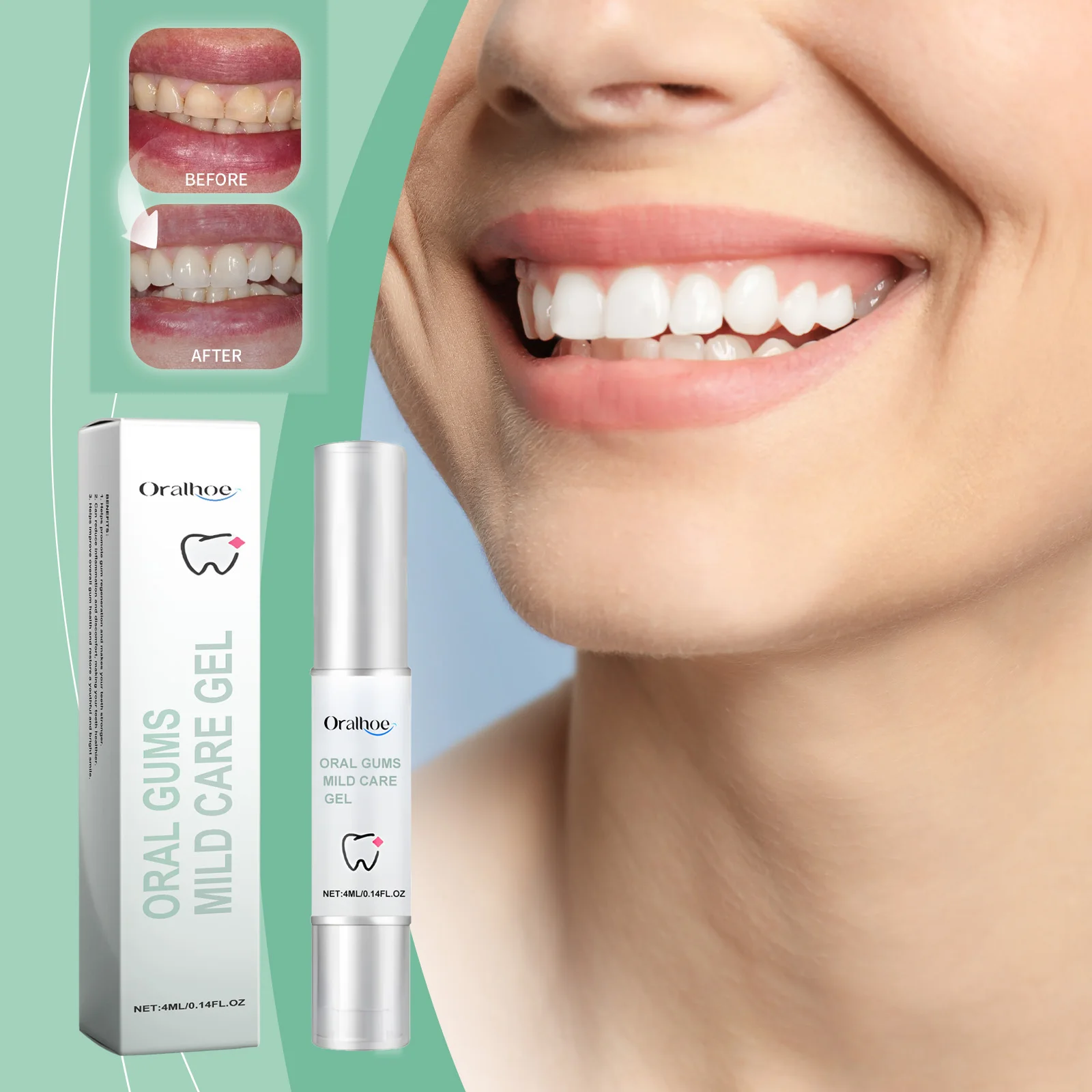 Gel de tratamiento instantáneo de las encías, alivia la recesión gingival, hinchazón, dolor, limpieza de manchas de placa, blanquea los dientes, antiinflamación gingival