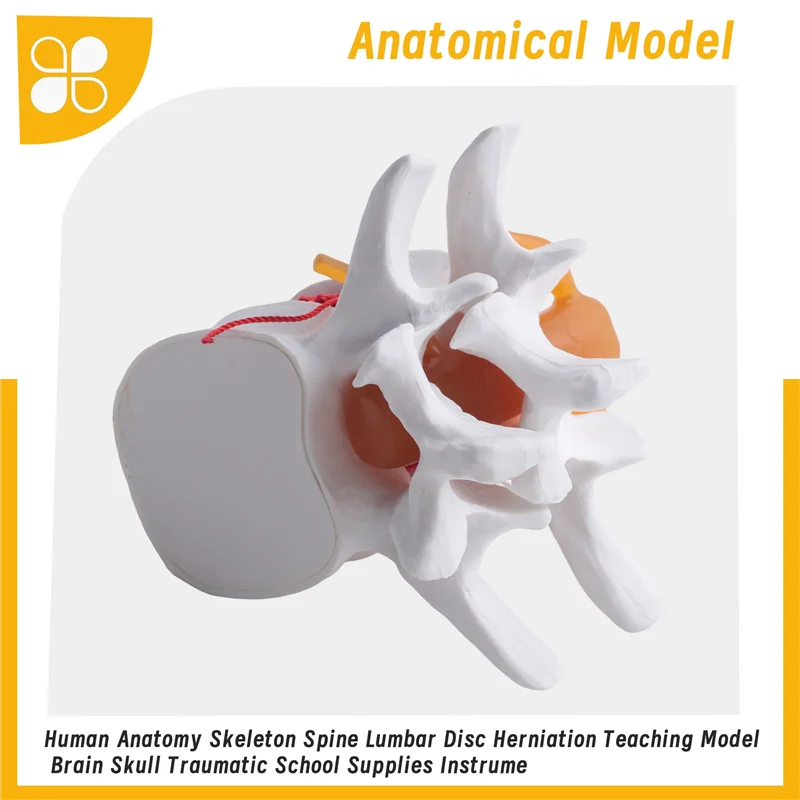 

A76F-Human Anatomy Skeleton Spine Lumbar Disc Herniation Teaching Model Brain Skull Traumatic School Supplies Instrume